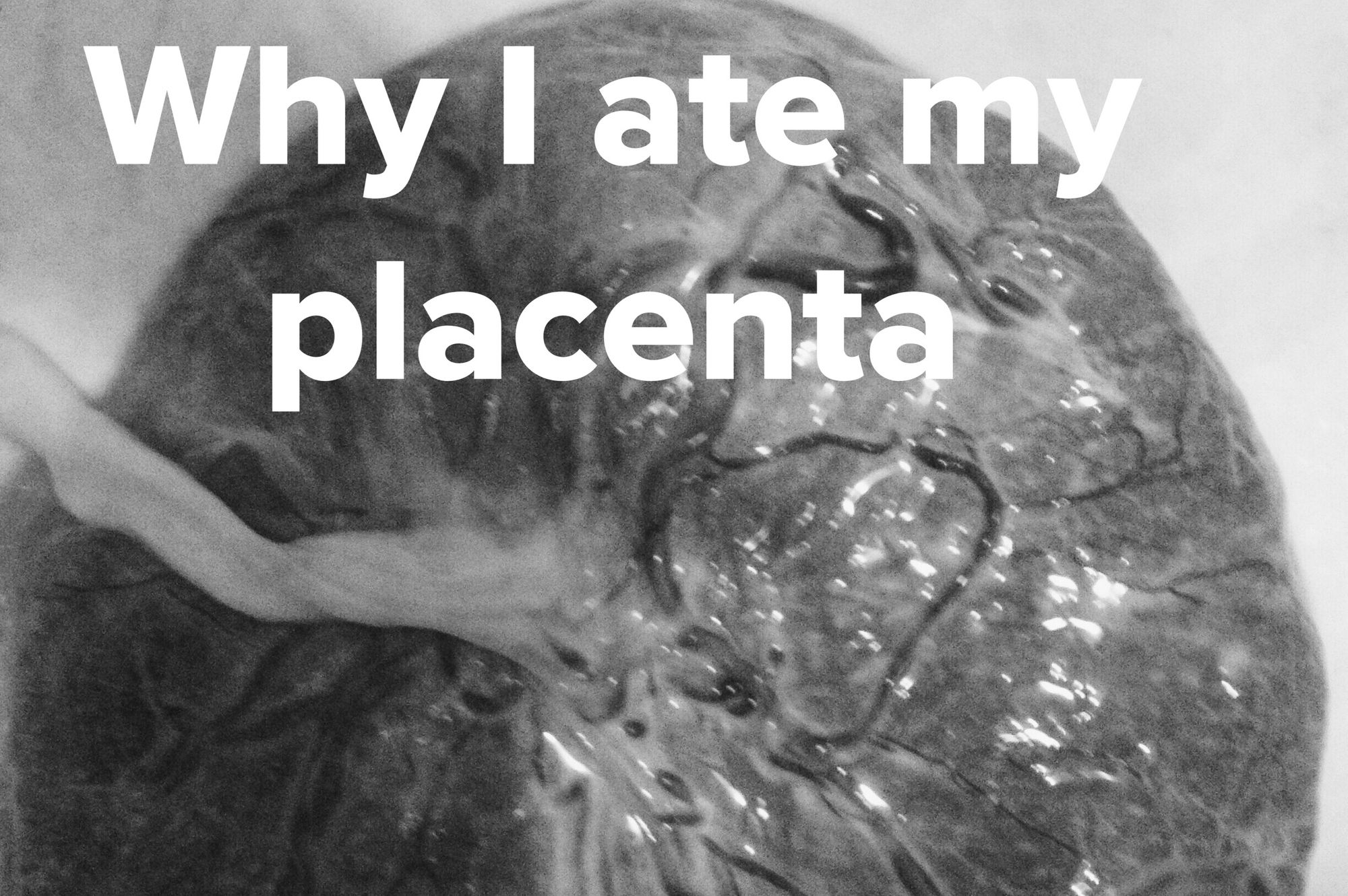 Yes, I ate my baby's placentas...
